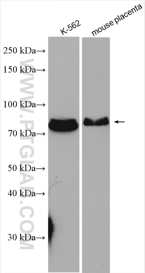 Western Blot (WB) analysis of various lysates using ARID3A Polyclonal antibody (14068-1-AP)
