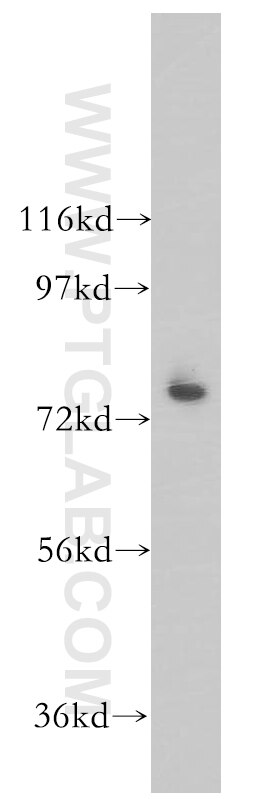 Western Blot (WB) analysis of K-562 cells using ARID3A Polyclonal antibody (14068-1-AP)