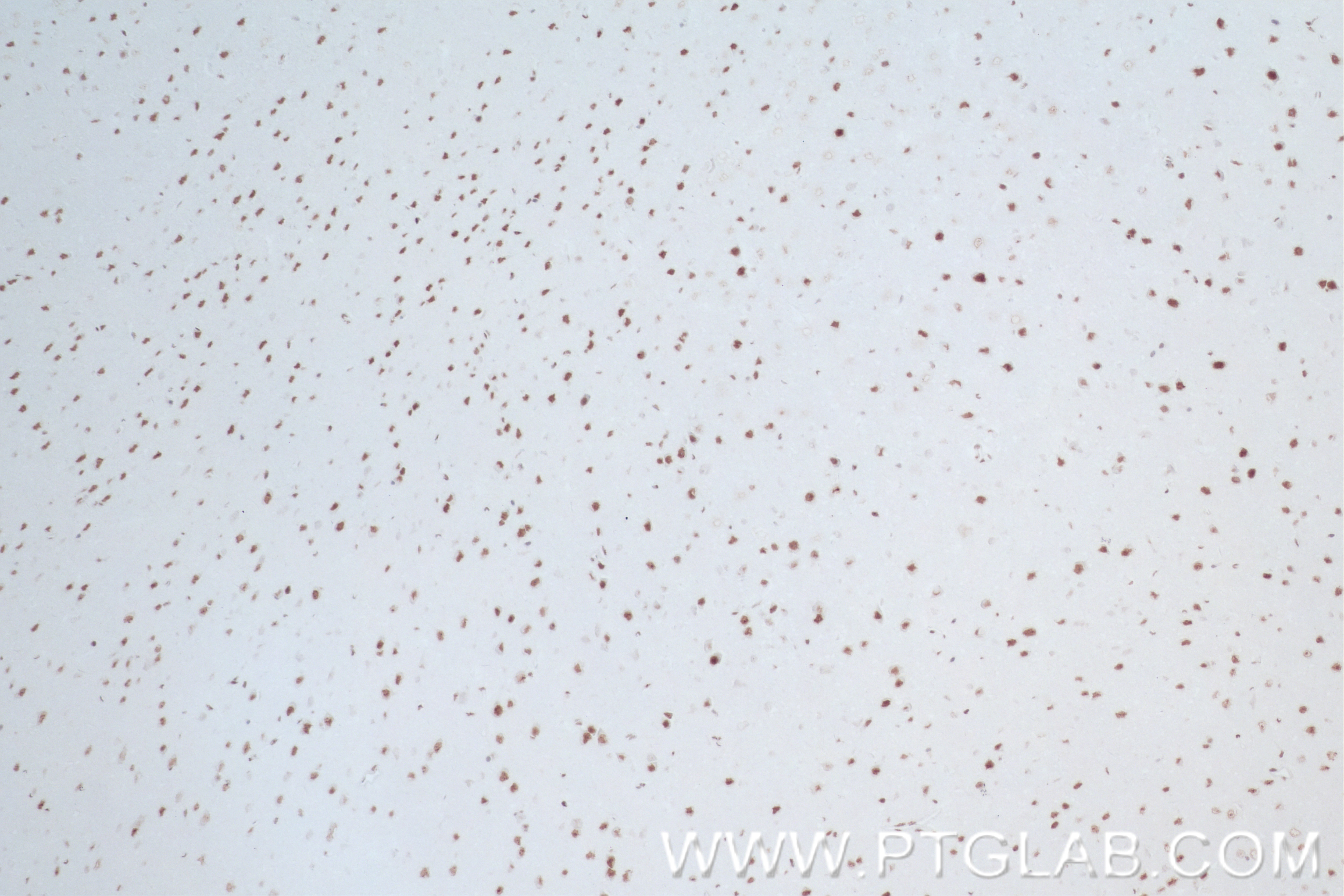 Immunohistochemistry (IHC) staining of mouse brain tissue using ARID4A Recombinant antibody (83489-1-RR)