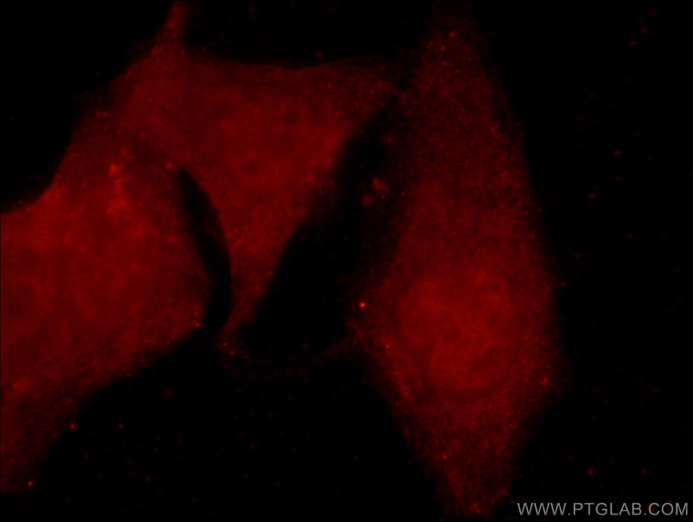 Immunofluorescence (IF) / fluorescent staining of MCF-7 cells using ARID4B Polyclonal antibody (24499-1-AP)