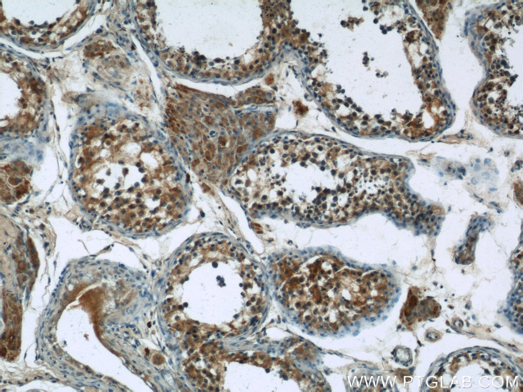 IHC staining of human testis using 24499-1-AP