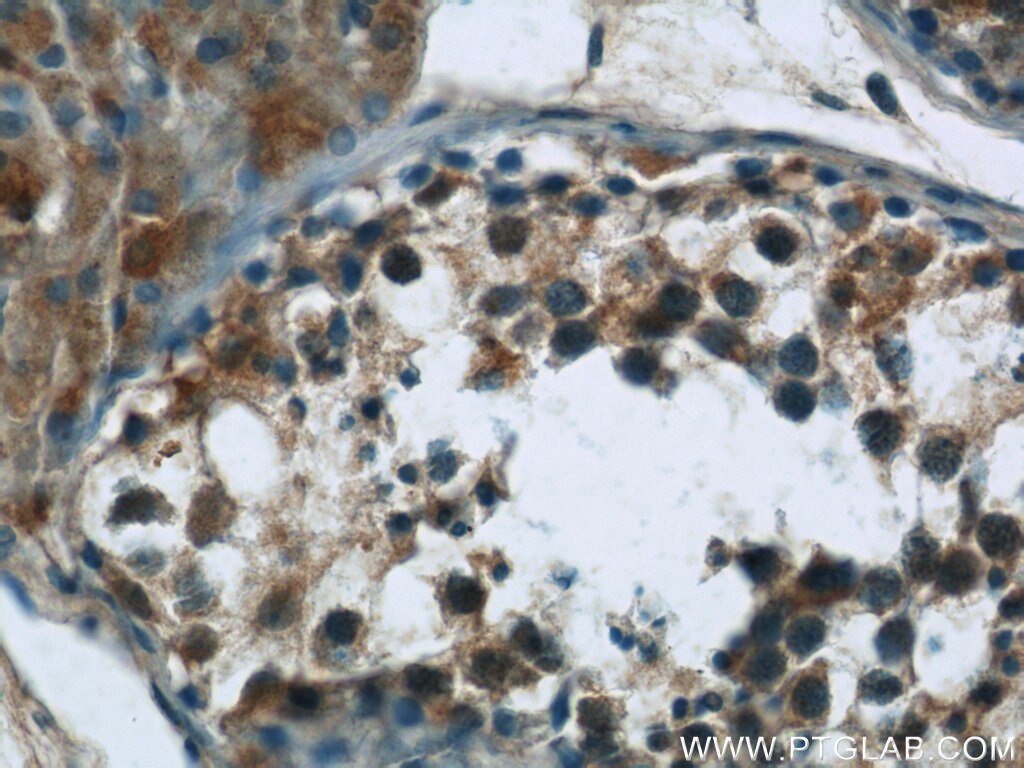 Immunohistochemistry (IHC) staining of human testis tissue using ARID4B Polyclonal antibody (24499-1-AP)