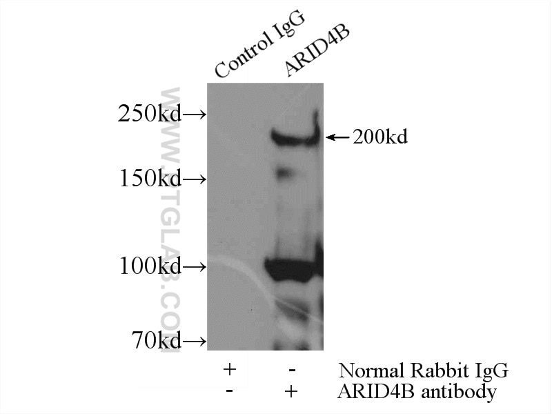 Immunoprecipitation (IP) experiment of MCF-7 cells using ARID4B Polyclonal antibody (24499-1-AP)