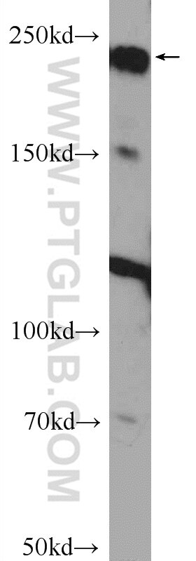 Western Blot (WB) analysis of A549 cells using ARID4B Polyclonal antibody (24499-1-AP)