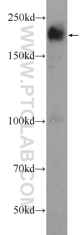 Western Blot (WB) analysis of MCF-7 cells using ARID4B Polyclonal antibody (24499-1-AP)