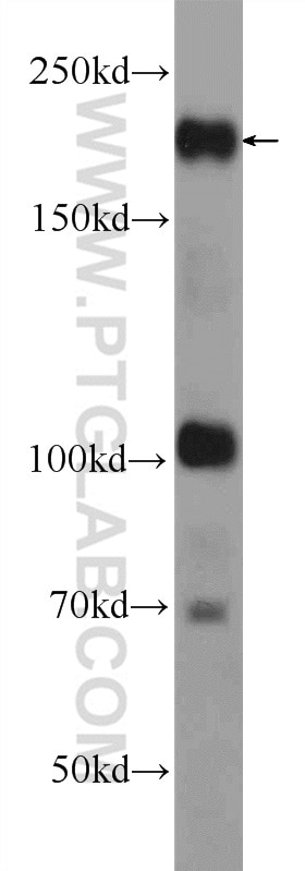 Western Blot (WB) analysis of K-562 cells using ARID4B Polyclonal antibody (24499-1-AP)