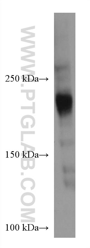 Western Blot (WB) analysis of T-47D cells using ARID4B Monoclonal antibody (67384-1-Ig)