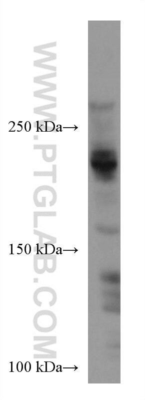 Western Blot (WB) analysis of MDA-MB-231 cells using ARID4B Monoclonal antibody (67384-1-Ig)