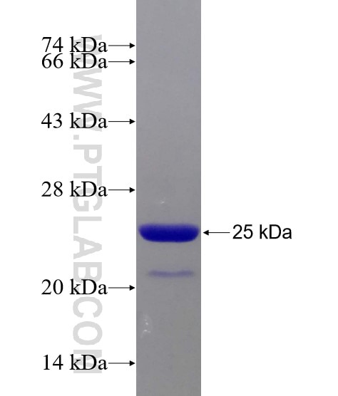 ARID4B fusion protein Ag21485 SDS-PAGE