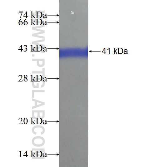 ARID4B fusion protein Ag21462 SDS-PAGE