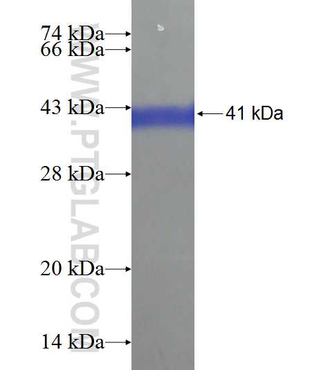 ARID4B fusion protein Ag21462 SDS-PAGE