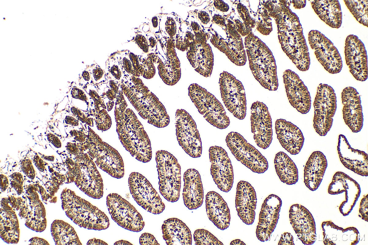 Immunohistochemistry (IHC) staining of mouse small intestine tissue using ARIH1 Polyclonal antibody (14949-1-AP)