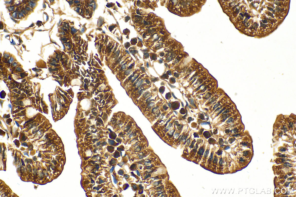 Immunohistochemistry (IHC) staining of mouse small intestine tissue using ARIH1 Polyclonal antibody (14949-1-AP)