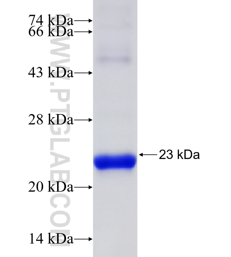 ARIH1 fusion protein Ag30740 SDS-PAGE ARIH1 fusion protein Ag30740 SDS-PAGE