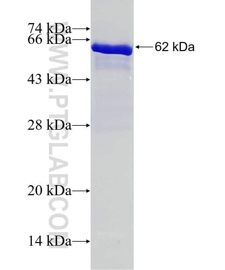 ARIH1 fusion protein Ag6760 SDS-PAGE