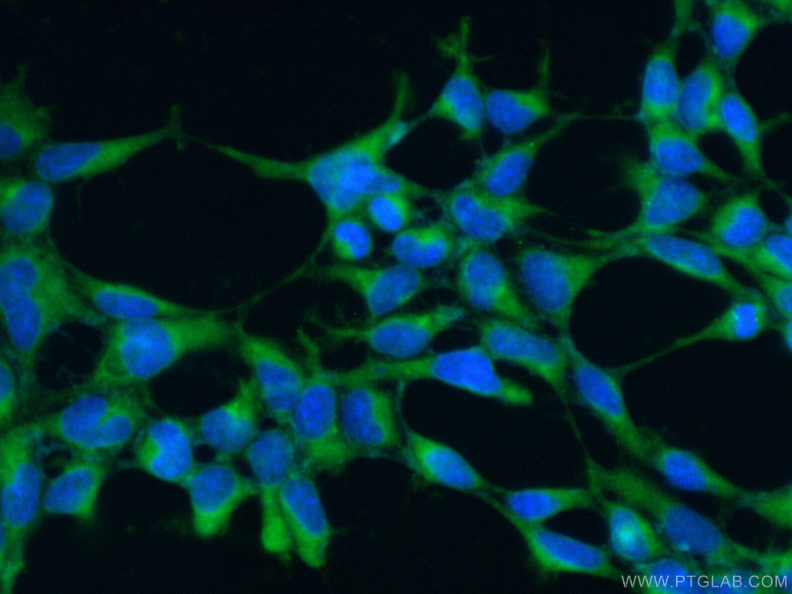 Immunofluorescence (IF) / fluorescent staining of HEK-293 cells using ARIH2 Polyclonal antibody (15006-1-AP)