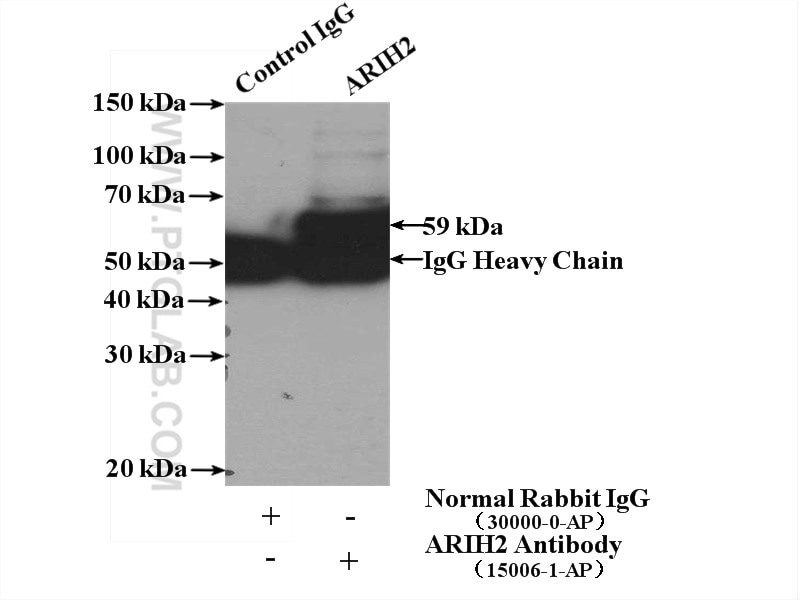 Immunoprecipitation (IP) experiment of HeLa cells using ARIH2 Polyclonal antibody (15006-1-AP)