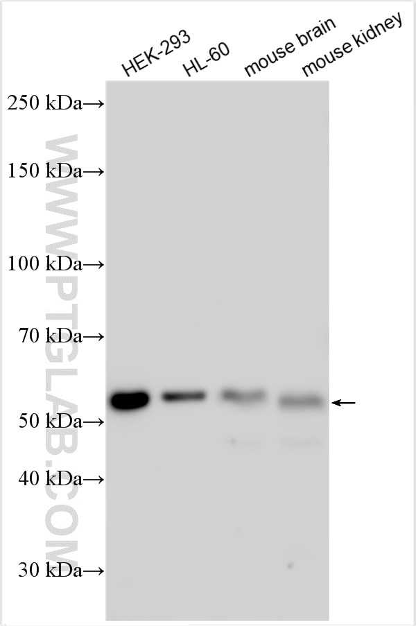 Western Blot (WB) analysis of various lysates using ARIH2 Polyclonal antibody (15006-1-AP)