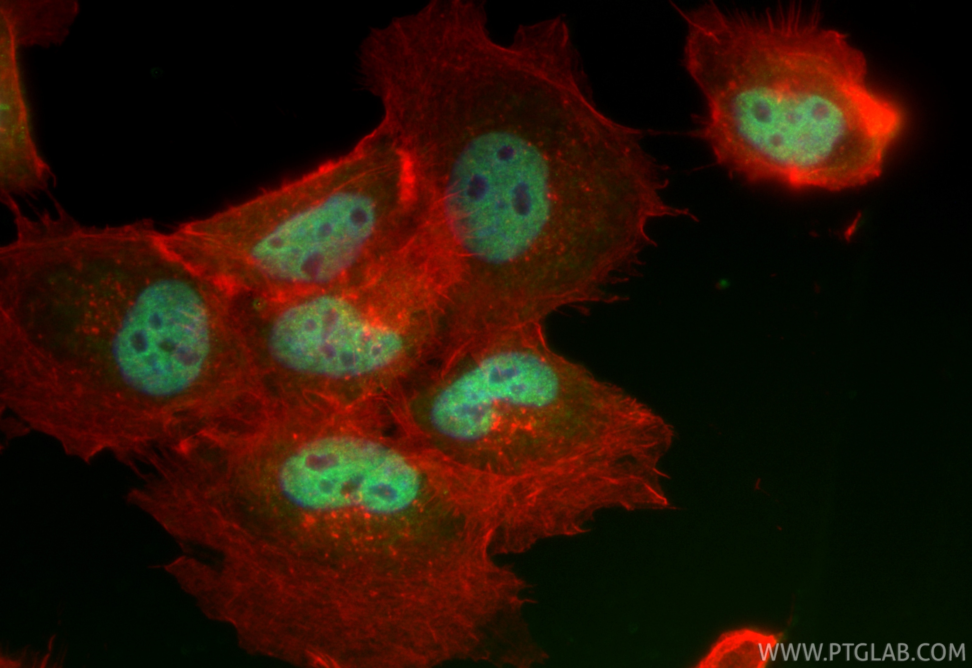 Immunofluorescence (IF) / fluorescent staining of A431 cells using CoraLite® Plus 488-conjugated ARK5 Recombinant ant (CL488-84893-5)