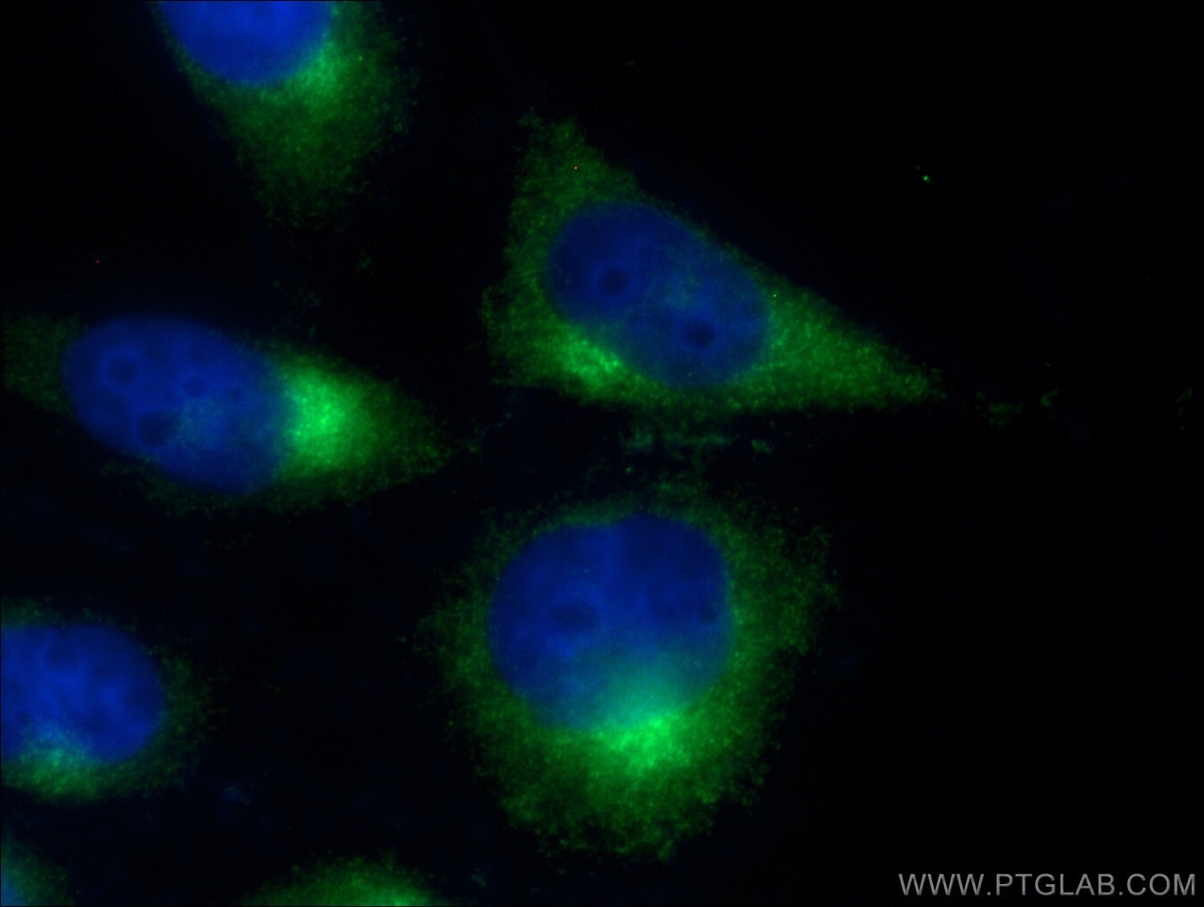 Immunofluorescence (IF) / fluorescent staining of HeLa cells using ARL1 Polyclonal antibody (16012-1-AP)