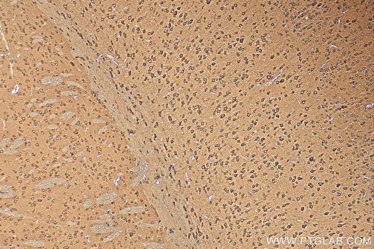 Immunohistochemistry (IHC) staining of mouse brain tissue using ARL1 Polyclonal antibody (16012-1-AP)