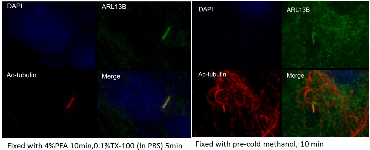 Immunofluorescence (IF) / fluorescent staining of hTERT-RPE1  cells using ARL13B Polyclonal antibody (17711-1-AP)