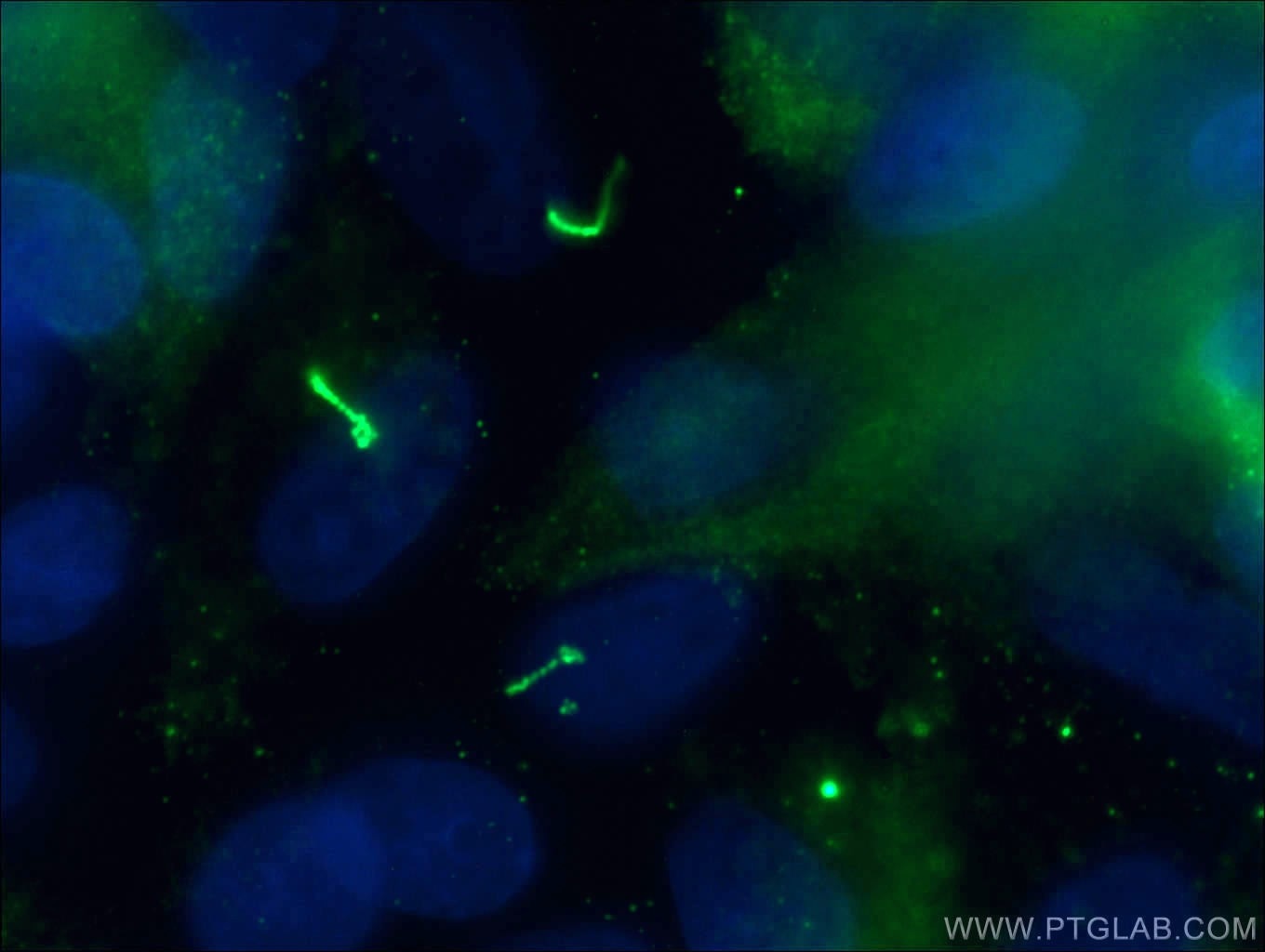 Immunofluorescence (IF) / fluorescent staining of MDCK cells using ARL13B Polyclonal antibody (17711-1-AP)