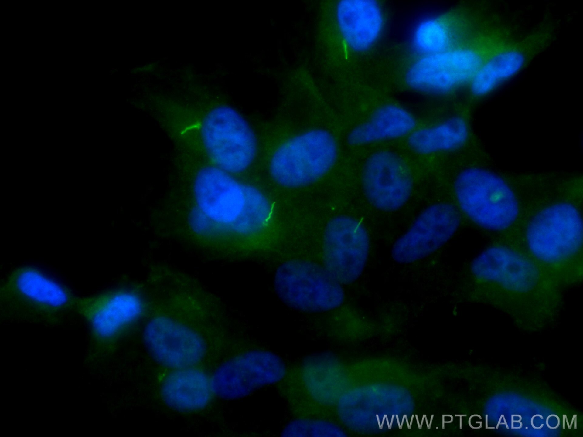 IF Staining of hTERT-RPE1 using 17711-1-AP