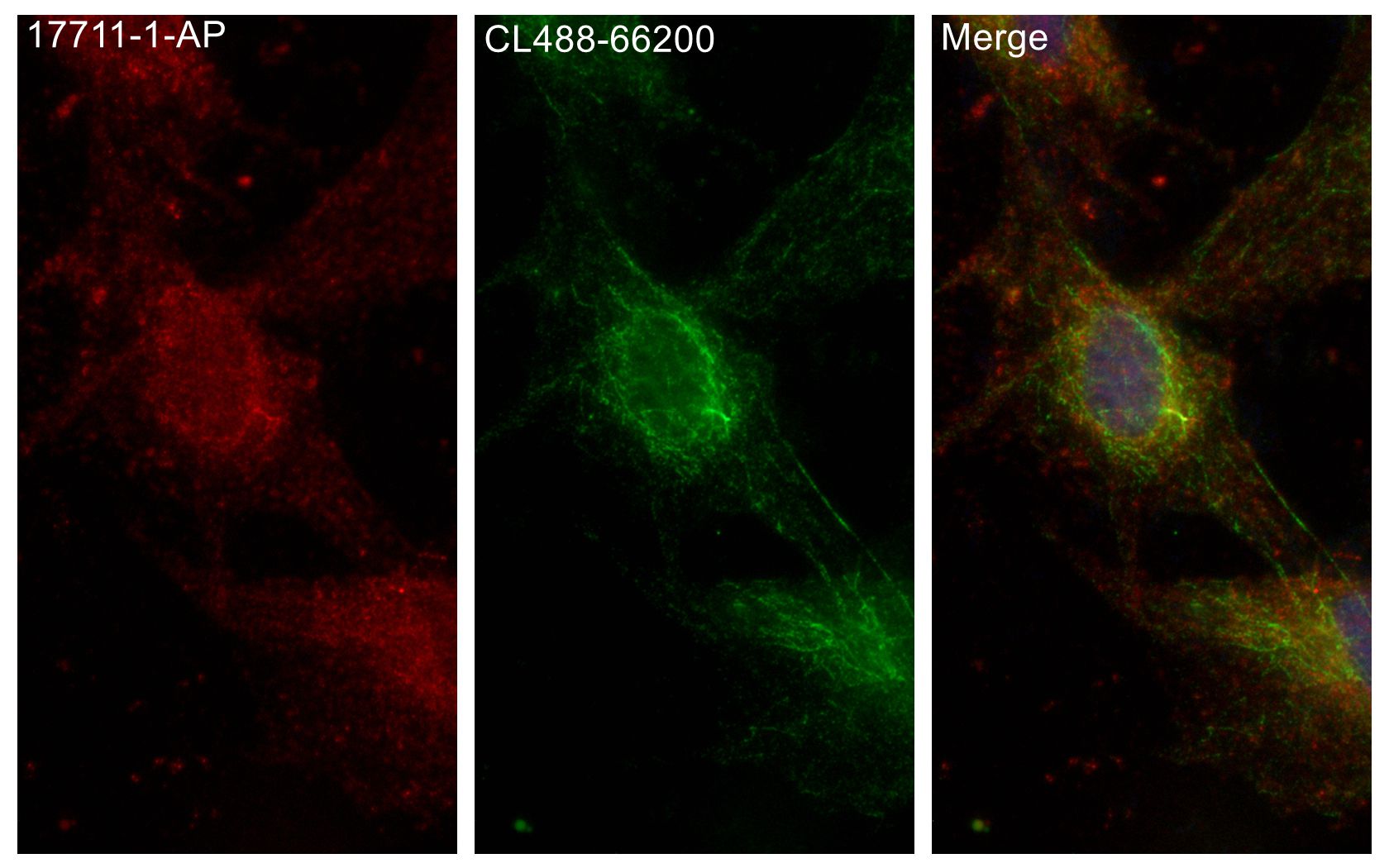 Immunofluorescence (IF) / fluorescent staining of MDCK cells using ARL13B Polyclonal antibody (17711-1-AP)