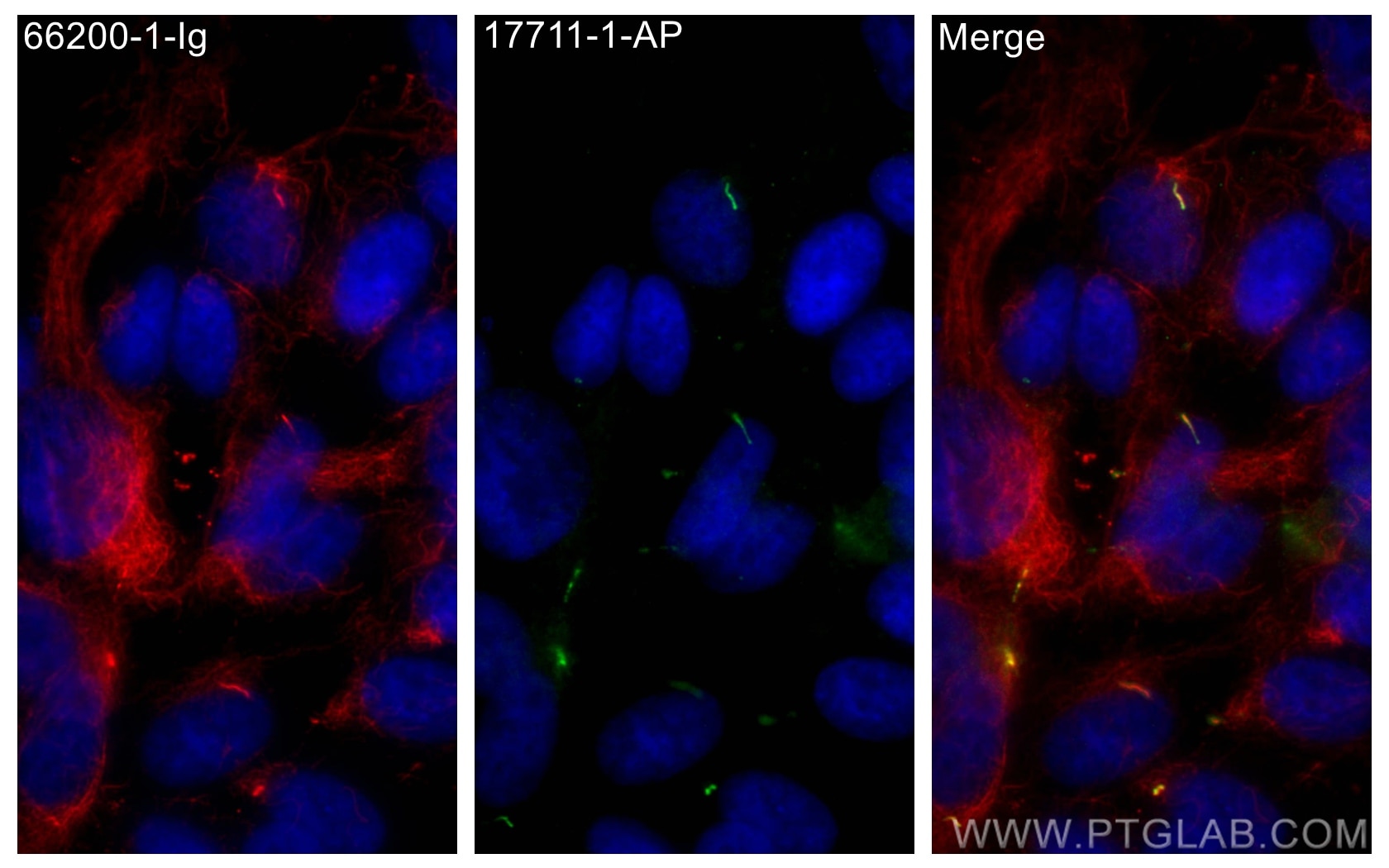 IF Staining of hTERT-RPE1 using 17711-1-AP