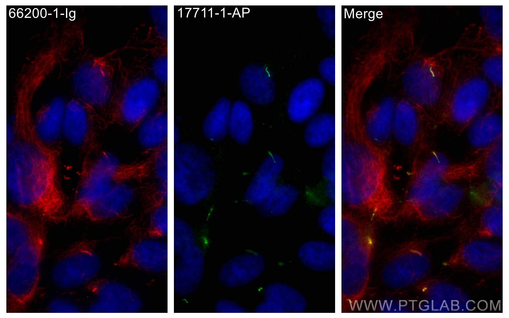 Immunofluorescence (IF) / fluorescent staining of hTERT-RPE1 cells using ARL13B Polyclonal antibody (17711-1-AP)