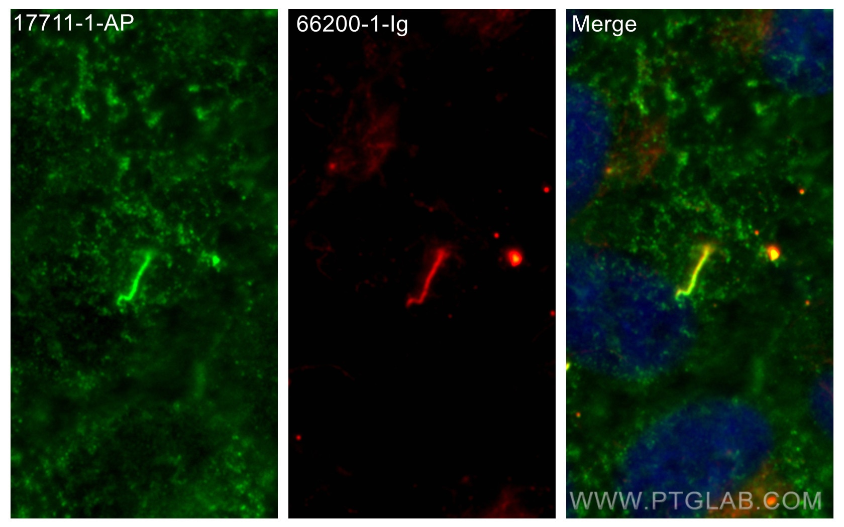 Immunofluorescence (IF) / fluorescent staining of hTERT-RPE1 cells using ARL13B Polyclonal antibody (17711-1-AP)