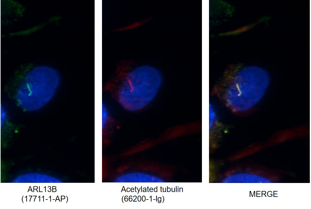 Immunofluorescence (IF) / fluorescent staining of MDCK cells using ARL13B Polyclonal antibody (17711-1-AP)