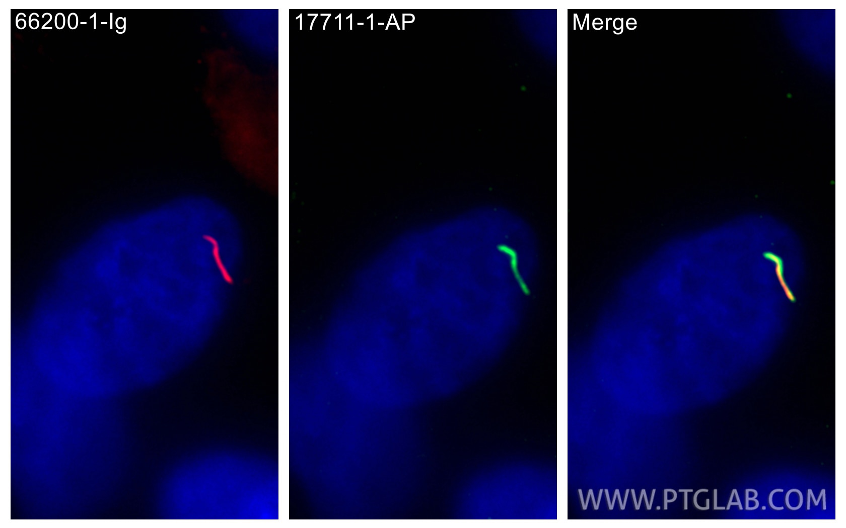 Immunofluorescence (IF) / fluorescent staining of hTERT-RPE1 cells using ARL13B Polyclonal antibody (17711-1-AP)