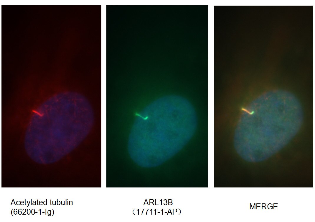 ARL13B Polyclonal antibody