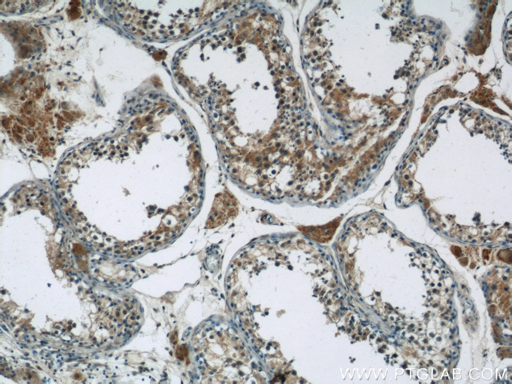 Immunohistochemistry (IHC) staining of human testis tissue using ARL13B Polyclonal antibody (17711-1-AP)