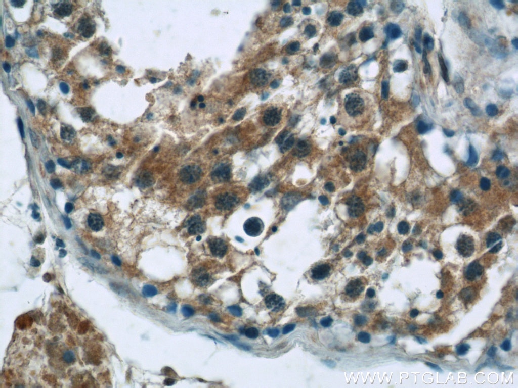 Immunohistochemistry (IHC) staining of human testis tissue using ARL13B Polyclonal antibody (17711-1-AP)