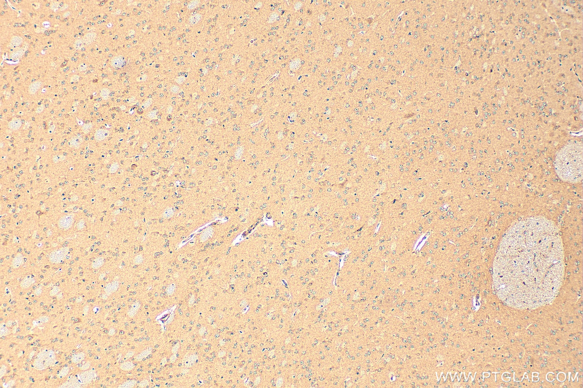 Immunohistochemistry (IHC) staining of mouse brain tissue using ARL13B Polyclonal antibody (17711-1-AP)
