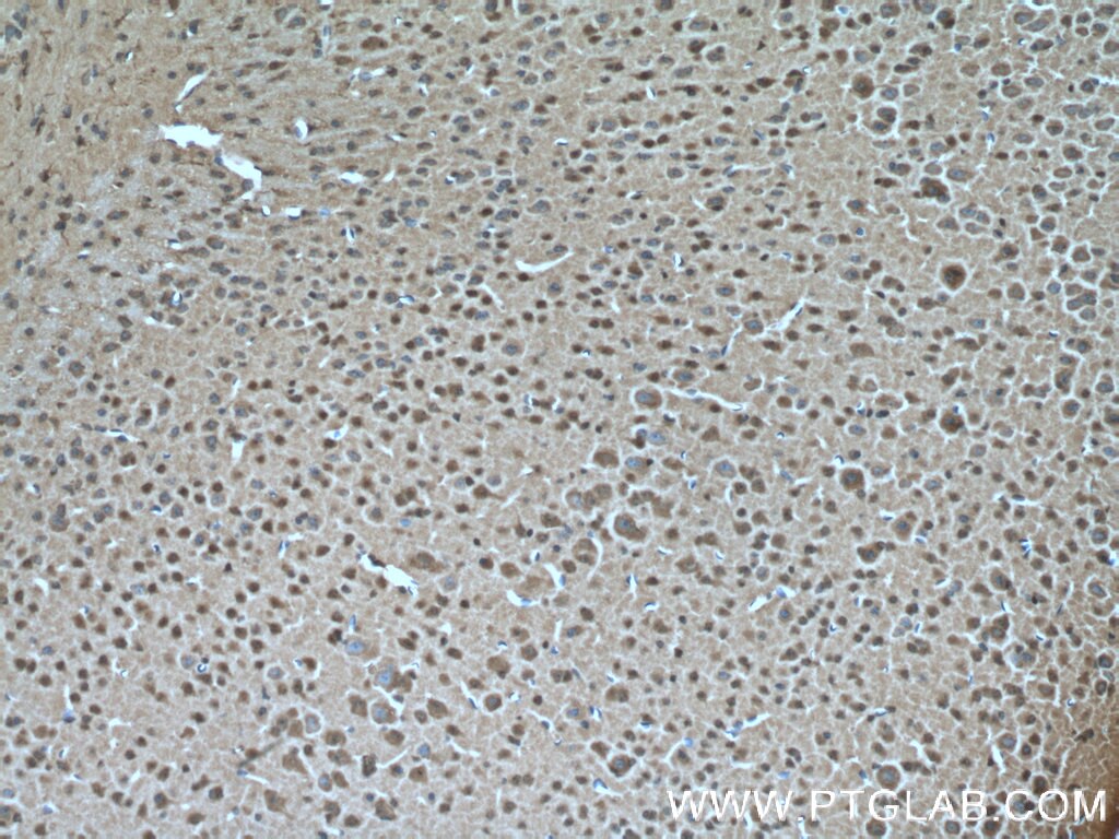 Immunohistochemistry (IHC) staining of mouse brain tissue using ARL13B Polyclonal antibody (17711-1-AP)