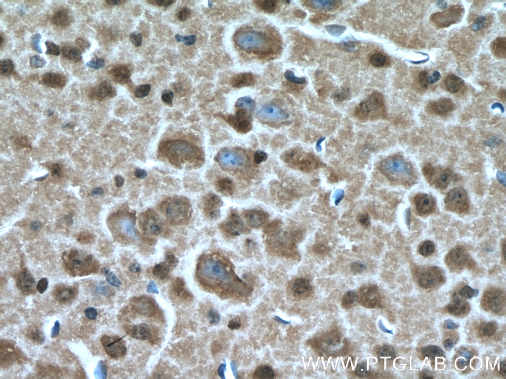 Immunohistochemistry (IHC) staining of mouse brain tissue using ARL13B Polyclonal antibody (17711-1-AP)
