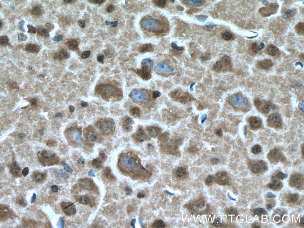 IHC staining of mouse brain using 17711-1-AP