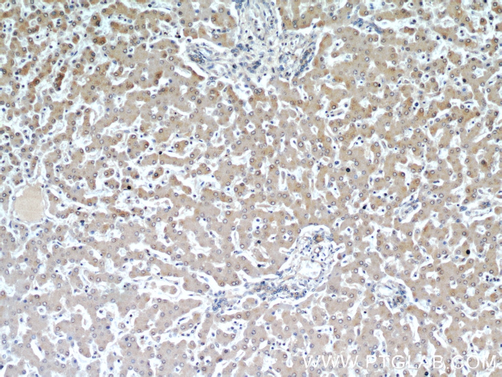Immunohistochemistry (IHC) staining of human liver tissue using ARL13B Polyclonal antibody (17711-1-AP)