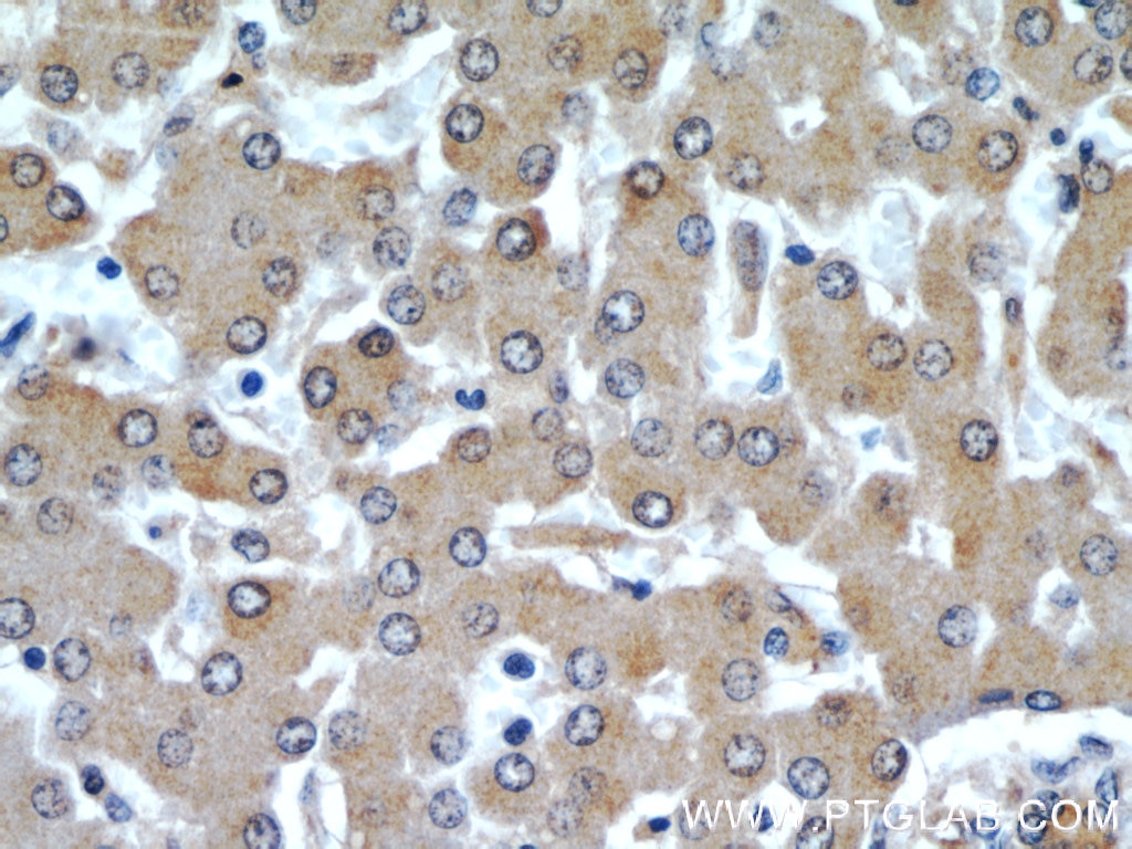 Immunohistochemistry (IHC) staining of human liver tissue using ARL13B Polyclonal antibody (17711-1-AP)