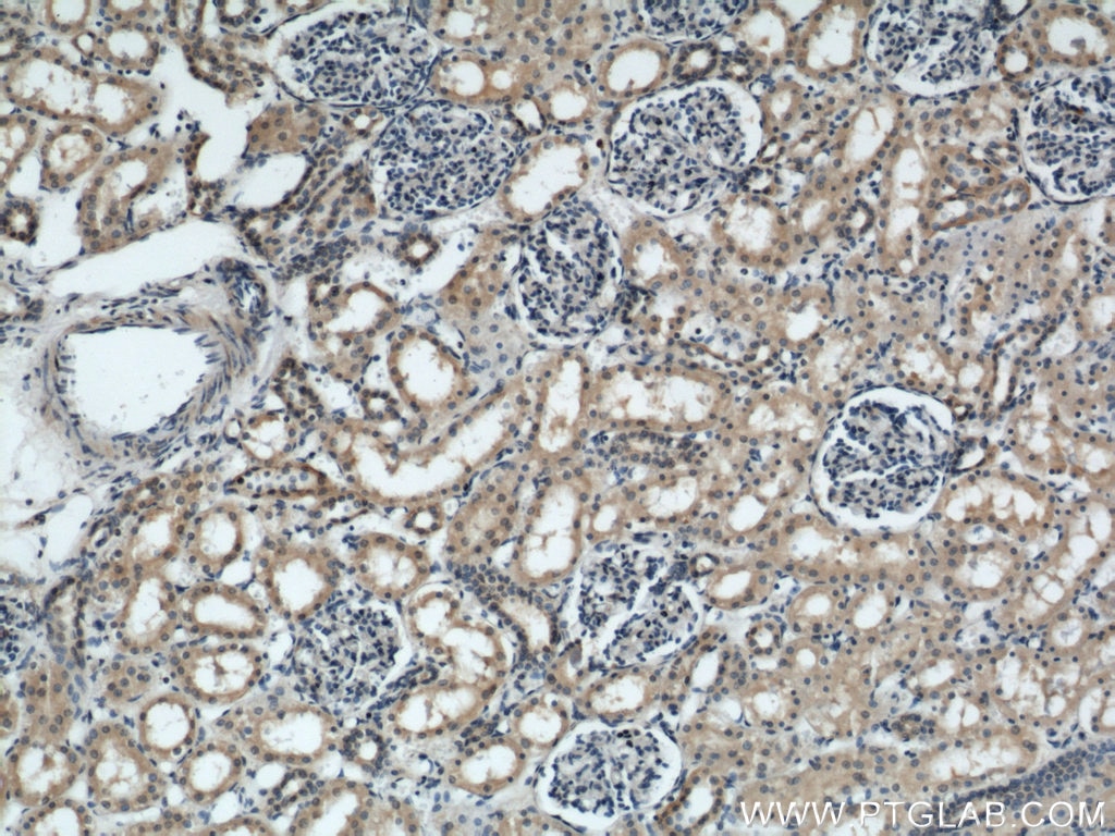 Immunohistochemistry (IHC) staining of human kidney tissue using ARL13B Polyclonal antibody (17711-1-AP)
