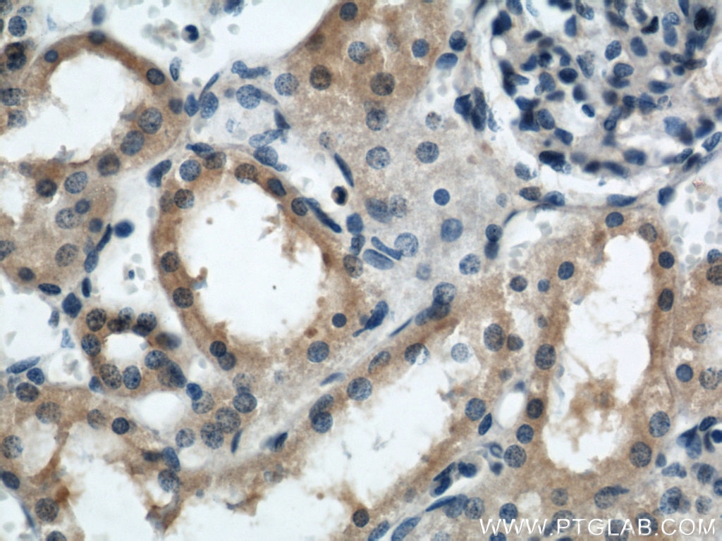 Immunohistochemistry (IHC) staining of human kidney tissue using ARL13B Polyclonal antibody (17711-1-AP)