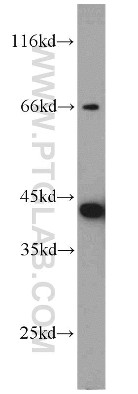 Western Blot (WB) analysis of mouse liver tissue using ARL13B Polyclonal antibody (17711-1-AP)