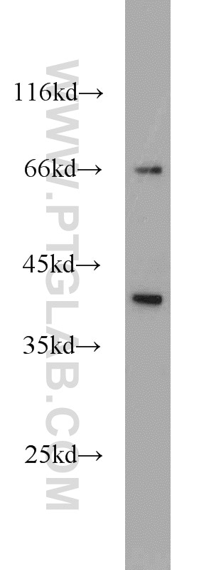 Western Blot (WB) analysis of mouse kidney tissue using ARL13B Polyclonal antibody (17711-1-AP)