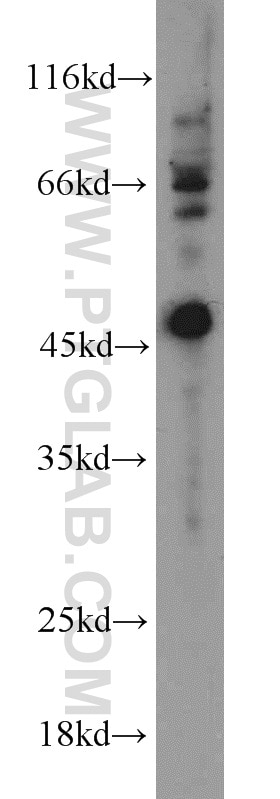 Western Blot (WB) analysis of mouse brain tissue using ARL13B Polyclonal antibody (17711-1-AP)