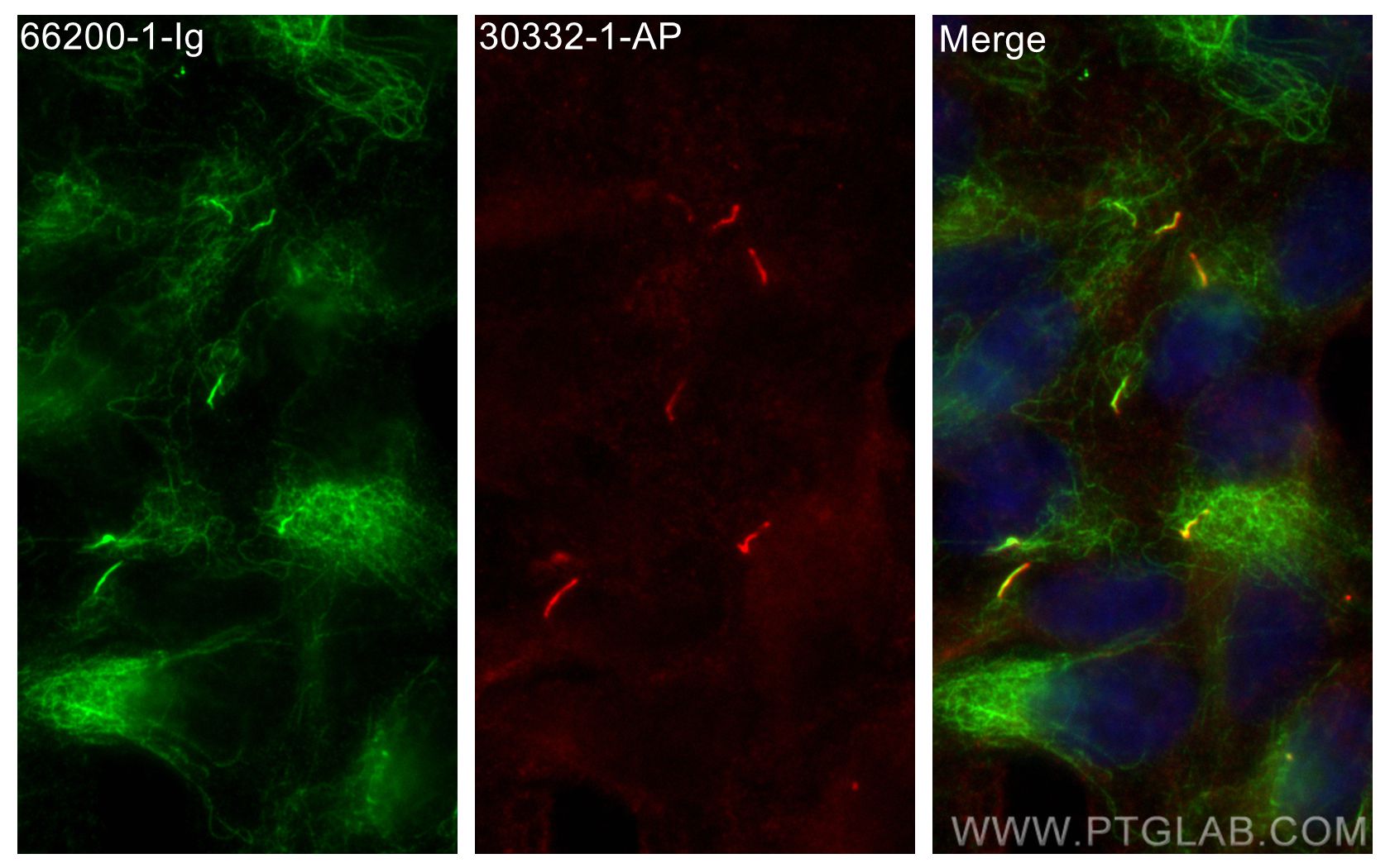 Immunofluorescence (IF) / fluorescent staining of hTERT-RPE1 cells using ARL13B Polyclonal antibody (30332-1-AP)