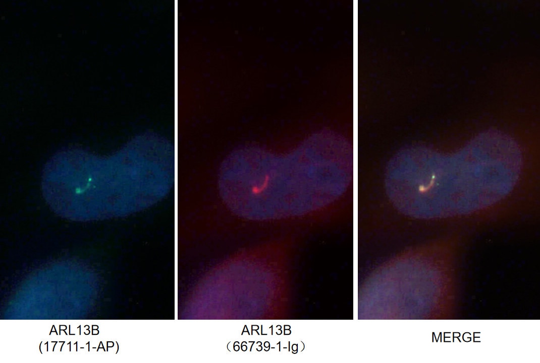 Immunofluorescence (IF) / fluorescent staining of MDCK cells using ARL13B Monoclonal antibody (66739-1-Ig)